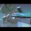 True Beam video