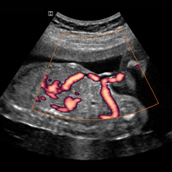 Circulación  de la sangre fetal