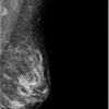 Imagen clinica 4