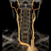 Abdomen y Pelvis