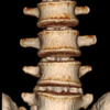 lumbar