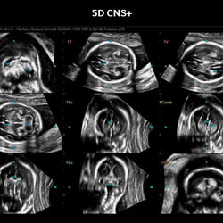 5D CNS+