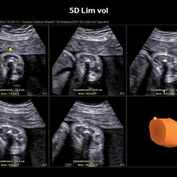 5D lim vol